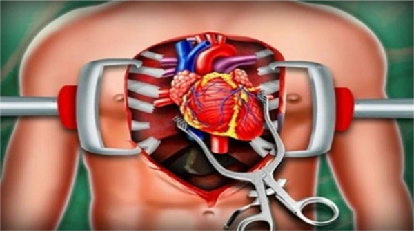 心脏手术模拟器截图